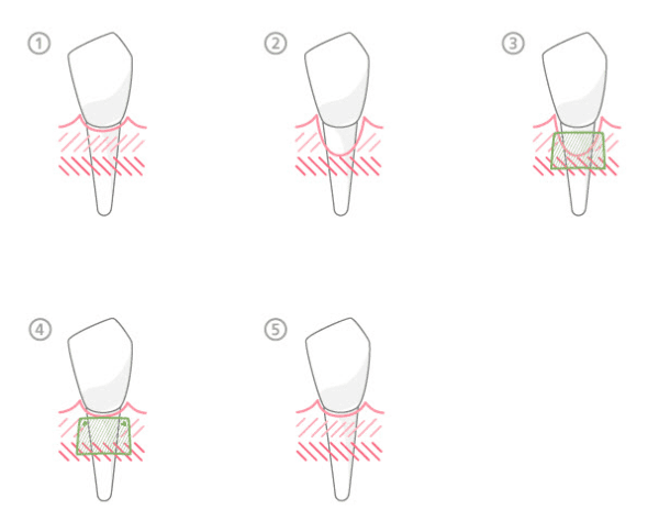 Connecttissgraf60 width= j David cross dds