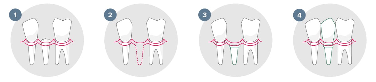 703256 RedesignToothGraphic 042120 J David Cross DDS j David cross dds